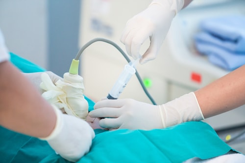 Ecografía diagnóstica y terapéutica, Cordocentesis  y Amniocentesis